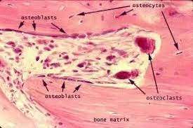 Important features in the bone cross section such as harvesian canals, osteons, osteon fragments, lamellar bone, bony trabeculae, myxoid matrix and artifact for. What Is The Microscopic Anatomy Of A Compact Bone Quora