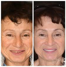 Lanier Family & Cosmetic Dentistry