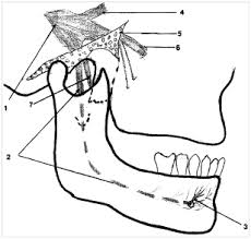 Numb Chin Syndrome With Sickle Cell Disease A Report Of Two Cases Medcrave Online