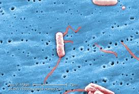 Image result for Legionella