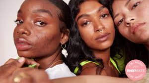 They are not in a state to bear expensive facial treatments settings so if you are having a hard time in carrying theses hard and stiff comedones (blackheads) with you 24/7 then you can have a manual. What Is Hyperpigmentation And How Do You Get Rid Of Dark Spots An Explainer Teen Vogue
