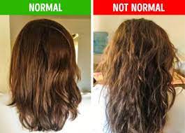 8 Things Your Hair Can Tell You About Your Health