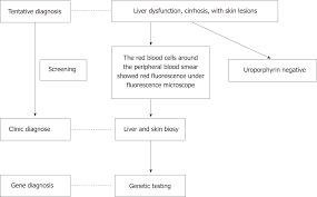 diagnosis of erythropoietic protoporphyria with severe liver