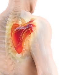 Image result for Winged Scapula