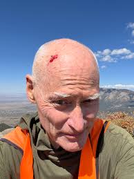 The photos of my bloody wounds are from two separate incidents while I was  hiking in the Sandia mountains. The elbow injury was from a fall…while