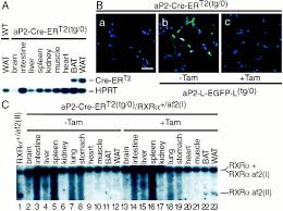 Ερτ2), formerly net (short for néa ellinikí tileórasi; Impaired Adipogenesis And Lipolysis In The Mouse Upon Selective Ablation Of The Retinoid X Receptor A Mediated By A Tamoxifen Inducible Chimeric Cre Recombinase Cre Ert2 In Adipocytes Pnas