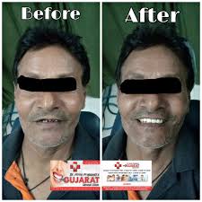 Book Dental surgeon Appointment. Book Doctor Counsultaion of Dr. Hiren  Prajapati