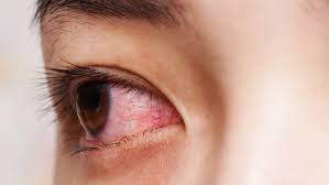 Waspada Ini Gejala Virus Corona Yang Tidak Biasa
