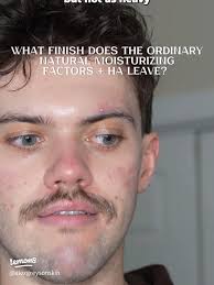 What Moisturizers Are Best for Sensitive Skin?