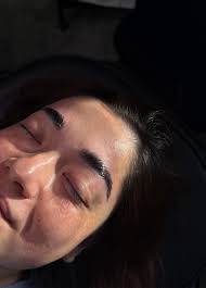 Where to get CIMT scans in the valley?