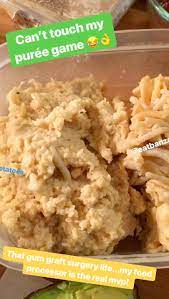 The Best Gluten Free And Vegan Soft Foods To Eat After Dental Surgery Part 2 Soft Foods To Eat Soft Foods Diet Wisdom Teeth Food