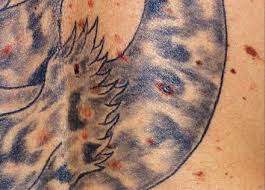 After finishing your tattoo, your tattoo artist will most likely suggest that you wait at least 48 hours before strenuous physical activity and heavy sweating. Can You Get A Tattoo Over Moles Authoritytattoo