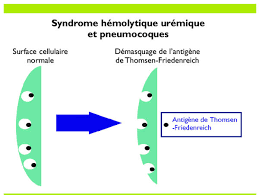 Pediatric autoimmune neuropsychiatric disorders associated with streptococcal infections: Les Syndromes Hemolytiques Uremiques Pas Si Rares Chez L Enfant Suisse