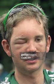 265 Jonathan Bee Stock Photos, High-Res Pictures, and Images