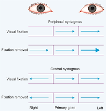 Image result for Visual Fixation