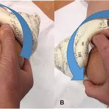 Image result for Manual Rotation in Occipitoposterior Presentation