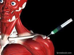 Image result for Scapulothoracic Injection