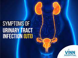 Recurrent uncomplicated urinary tract infections in women: Urinary Tract Infections Symptoms In Women Vinn Hospital