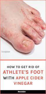 Pin On Health Wellness