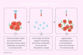 Image result for Direct Coombs