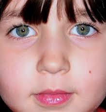 Nikon D3x + Nikkor 105mm f2.8 macro + SB 900 + Ray ring fl…