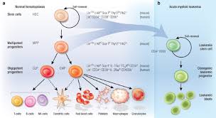 Some types of cancer, called leukaemia, start from blood cells. The Cancer Stem Cell Hypothesis A Work In Progress Laboratory Investigation