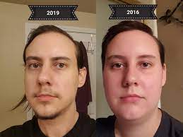 M 29 6 184 Cm 230 Lbs 104 5 Kg 140 Lbs 63 5 Kg 90 Lbs 41 Kg Lost 35 Months Sorry About The Format The After Is On The Left Progresspics As a base unit of si, the kilogram is used globally in nearly all fields and applications, with the exception of countries like the united states, where the kilogram is used in many areas, at least to some extent. m 29 6 184 cm 230 lbs 104 5 kg