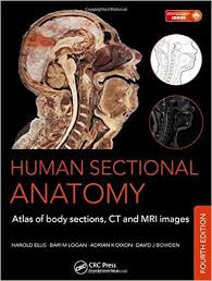 Human Sectional Anatomy 4th Edition Read Download Online Libribook
