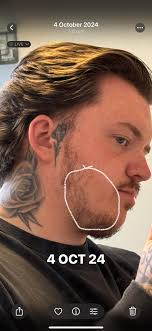 Dr. Roach: I am a 70-year-old man and have been taking finasteride for hair  loss for about five years. I realized while reading your recent column that  I have the