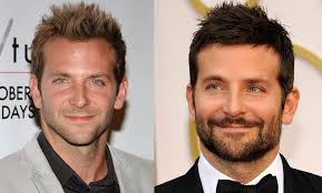 Maybe you would like to learn more about one of these? Has Bradley Cooper Had A Hair Transplant Top Hair Loss Treatments