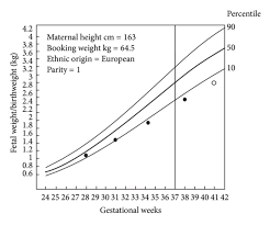 example of customized growth charts chart representing