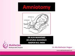 Image result for Amniotomy