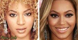 Cirugia Plastica Beyonce Antes Despues De La Nariz Beyonce Nose Job Beyonce Nose Nose Job