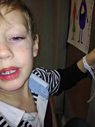 Autistic boy was rolled up in blanket; daycare worker pleads guilty