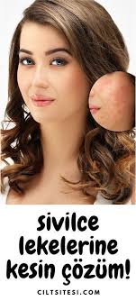 Effektivsten Sivilceler Aknespots Masken Fur Die Fr11 Die Effektivsten Masken Fur Akne Spots Sivilceler Acne Spots Face Mapping Acne Skin Care Acne