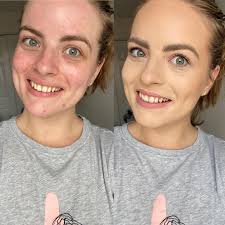 Authentic skin care products for all skin types