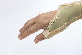 Image result for Long Arm Splint