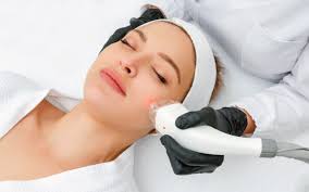 IPL vs Vbeam: Which is Best for You? | Modern Body Clinic
