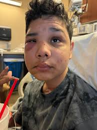 Eric Chial's Mental Health and Support System