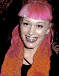 Gwen Stefani Mood As Heck Pink Hair Braces Gwen Stefani Style Gwen Stefani Gwen Stefani And Blake