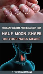 The Lunula Of Your Nails Or The White Half Moon As Most People Know It Is A Sensitive Part Of Your Body Which You Nailed It Health And Beauty Tips Nail Health