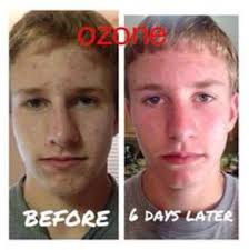 Wine & Wrinkle Spa Party