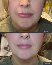 BEAUTIFULLY BALANCED