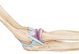 Image result for Elbow Dislocation