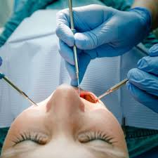 Sie erscheinen jeweils im unterkiefer und im oberkiefer auf beiden seiten. Drogenabhangig Durch Weisheitszahn Op Dieser Grund Steckt Dahinter Gesundheit