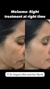 Dr. Gagandeep Kaur MD_SKIN (@drgagandeepkaurmd) · Instagram 照片和视频