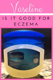 Is Vaseline Good For Eczema Vaseline Will Help Eczema In Certain Situations And Might Make It Worse Check Out My Thoug Eczema Cure Eczema Cure For Allergies