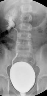 Log In Radiopaedia Org Radiology Reflux Medical Imaging