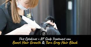 I am 30 years old.how to turn my white hair into black by homeopathy treatment. This New Cytokines Radiofrequency Scalp Treatment Can Increase Hair Growth And Turn Grey Hair Black