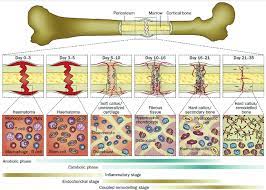 Illustration Of A Typical Fracture Healing Process Biological Events Download Scientific Diagram
